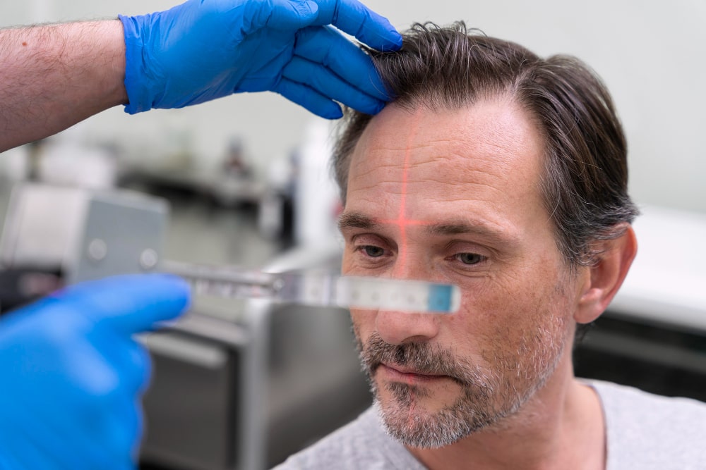 man-getting-hair-loss-treatment-min